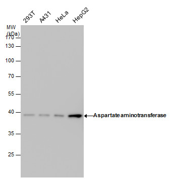 Anti-Aspartate aminotransferase antibody [GT638] used in Western blot. GTX632031