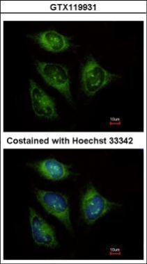 Anti-ABCF3 antibody [N1N3] used in ICC/IF. GTX119931