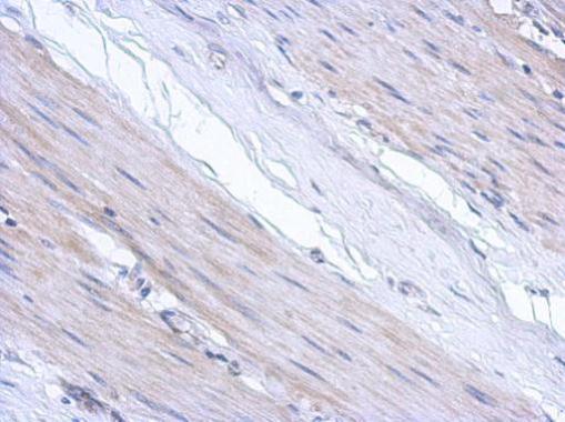 Anti-ABCF3 antibody [N1N3] used in IHC (Formalin-fixed paraffin-embedded sections). GTX119931