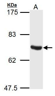 Anti-ATG14 antibody used in Western blot. GTX119950