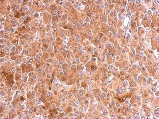 Anti-ATG14 antibody used in IHC (Formalin-fixed paraffin-embedded sections). GTX128166