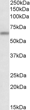 Anti-ATG16L1 antibody, Internal used in Western blot. GTX88747