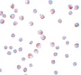 Anti-ATG9B antibody used in ICC/IF. GTX85184