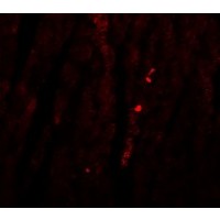Anti-ATG9B antibody used in ICC/IF. GTX85184