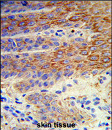 Anti-ATP12A antibody, Internal used in IHC (Formalin-fixed paraffin-embedded sections). GTX81091
