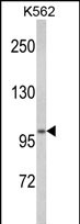 Anti-ATP12A antibody, Internal used in Western blot. GTX81091