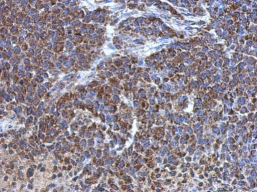 Anti-ATP5J antibody used in IHC (Formalin-fixed paraffin-embedded sections). GTX110996