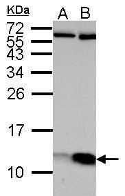 Anti-ATP5J antibody used in Western blot. GTX110996