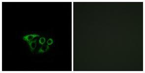 Anti-ATP5L2 antibody used in ICC/IF. GTX87665