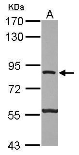 Anti-ATP6V0A2 antibody [N1N3] used in Western blot. GTX111275