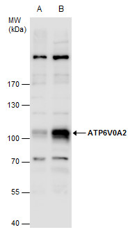 Anti-ATP6V0A2 antibody [N2C1], Internal used in Western blot. GTX110248
