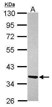 Anti-ATPAF1 antibody [N2C3] used in Western blot. GTX119210
