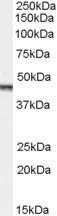 Anti-Aurora kinase A / AURKA antibody, C-term used in Western blot. GTX29689