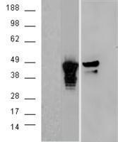 Anti-Aurora kinase A / AURKA antibody, C-term used in Western blot. GTX29689