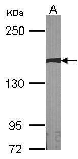 Anti-AUTS2 antibody [N3C1], Internal used in Western blot. GTX109811