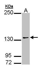 Anti-AUTS2 antibody [N3C1], Internal used in Western blot. GTX109811