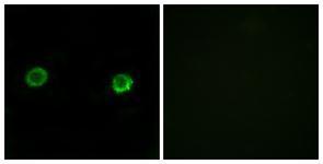 Anti-ABHD2 antibody used in ICC/IF. GTX87133