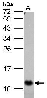 Anti-B2m antibody used in Western blot. GTX127323