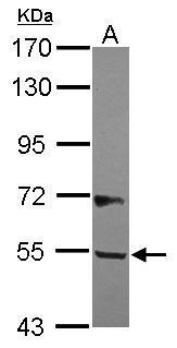 Anti-B3GALNT2 antibody [N1C2] used in Western blot. GTX121194