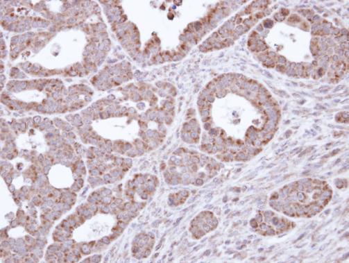Anti-B3GALTL antibody used in IHC (Formalin-fixed paraffin-embedded sections). GTX109849