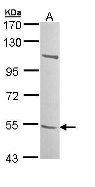 Anti-B3GALTL antibody used in Western blot. GTX109849