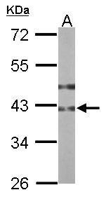 Anti-B3GNT3 antibody used in Western blot. GTX108928