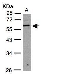 Anti-B3GNT3 antibody used in Western blot. GTX108928