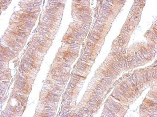 Anti-B3GNT3 antibody used in IHC (Formalin-fixed paraffin-embedded sections). GTX108928