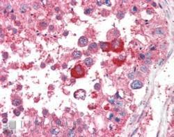 Anti-B5 Receptor / PCID1 / EIF3M antibody, C-term used in IHC (Formalin-fixed paraffin-embedded sections). GTX89456