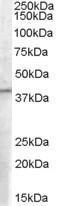 Anti-B5 Receptor / PCID1 / EIF3M antibody, C-term used in Western blot. GTX89456