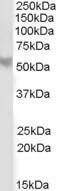 Anti-B56 beta isoform antibody, C-term used in Western blot. GTX89971