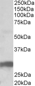 Anti-B7-H4 antibody, Internal used in Western blot. GTX88996