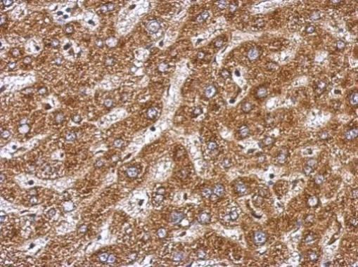 Anti-BAAT antibody used in IHC (Formalin-fixed paraffin-embedded sections). GTX109917