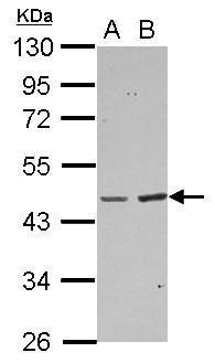 Anti-BAAT antibody used in Western blot. GTX109917