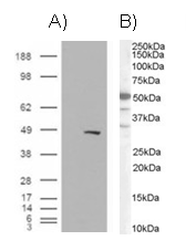 Anti-BAF57 / SMARCE1 antibody, C-term used in Western blot. GTX89755