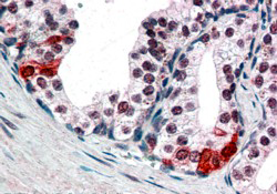 Anti-BAF57 / SMARCE1 antibody, C-term used in IHC (Formalin-fixed paraffin-embedded sections). GTX89755