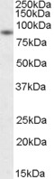 Anti-BAG3 / BIS/ CAIR1 antibody, C-term used in Western blot. GTX25898