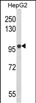 Anti-BANK1 antibody, Internal used in Western blot. GTX81106
