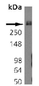Anti-Bassoon antibody [SAP7F407] used in Western blot. GTX13249