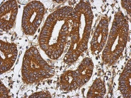 Anti-BAT5 antibody used in IHC (Formalin-fixed paraffin-embedded sections). GTX119080