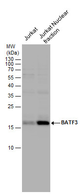 Anti-BATF3 antibody used in Western blot. GTX130125