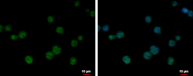 Anti-BCL7C antibody used in ICC/IF. GTX115214