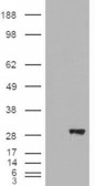 Anti-BDH2 / DHRS6 (aa 60 to 71) antibody, Internal used in Western blot. GTX88892