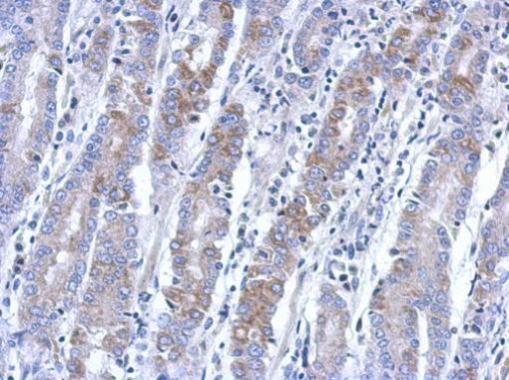 Anti-BEND2 antibody [N3C2], Internal used in IHC (Formalin-fixed paraffin-embedded sections). GTX120655