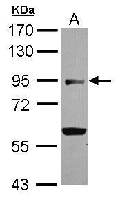 Anti-BEND2 antibody [N3C2], Internal used in Western blot. GTX120655