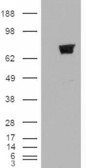 Anti-BERP / RNF22 antibody, N-term used in Western blot. GTX89826