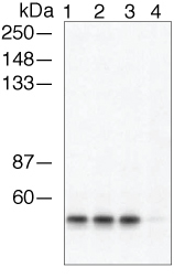 Anti-beta 1 Arrestin (phospho Ser412) antibody used in Western blot. GTX24472