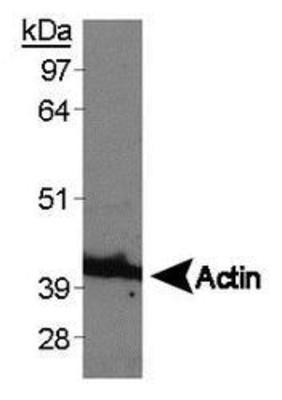Anti-beta Actin antibody used in Western blot. GTX30632