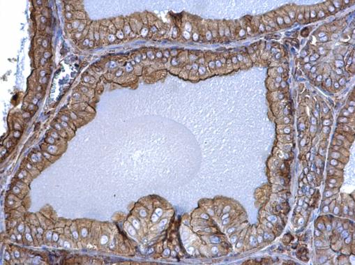 Anti-beta Actin antibody used in IHC (Formalin-fixed paraffin-embedded sections). GTX100313