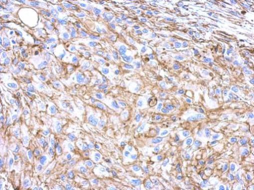 Anti-beta Actin antibody used in IHC (Formalin-fixed paraffin-embedded sections). GTX100313
